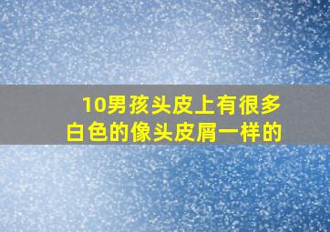 10男孩头皮上有很多白色的像头皮屑一样的