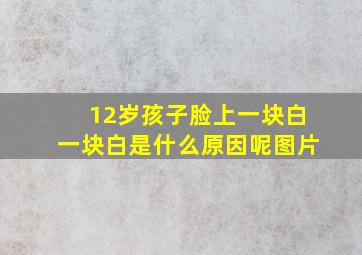 12岁孩子脸上一块白一块白是什么原因呢图片