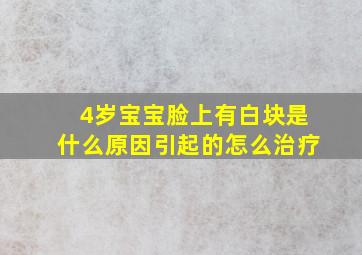 4岁宝宝脸上有白块是什么原因引起的怎么治疗