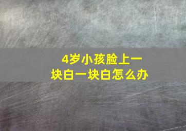 4岁小孩脸上一块白一块白怎么办