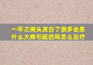 一年之间头发白了很多会是什么大病引起的吗怎么治疗