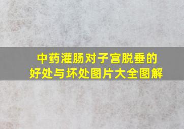 中药灌肠对子宫脱垂的好处与坏处图片大全图解