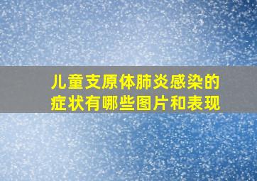 儿童支原体肺炎感染的症状有哪些图片和表现