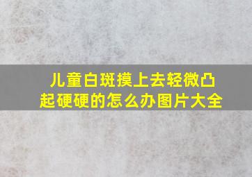 儿童白斑摸上去轻微凸起硬硬的怎么办图片大全