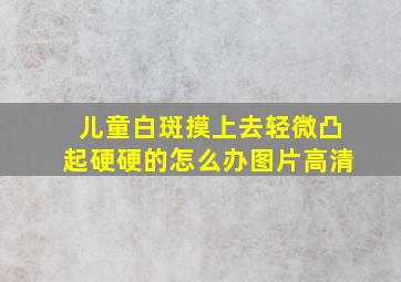 儿童白斑摸上去轻微凸起硬硬的怎么办图片高清