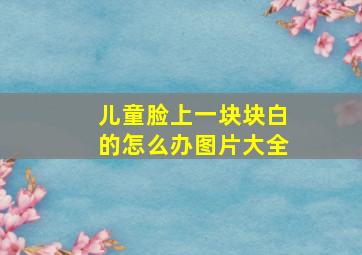 儿童脸上一块块白的怎么办图片大全