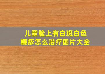 儿童脸上有白斑白色糠疹怎么治疗图片大全