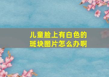 儿童脸上有白色的斑块图片怎么办啊