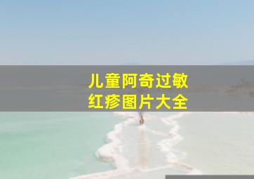 儿童阿奇过敏红疹图片大全