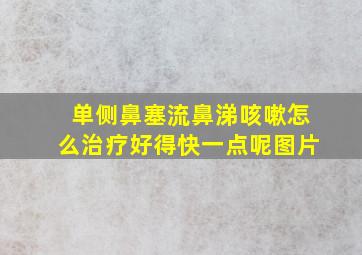 单侧鼻塞流鼻涕咳嗽怎么治疗好得快一点呢图片