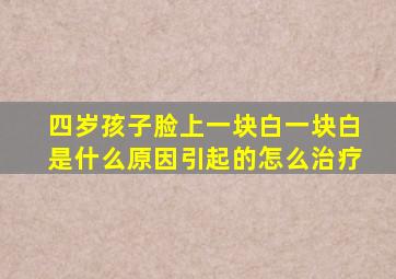 四岁孩子脸上一块白一块白是什么原因引起的怎么治疗