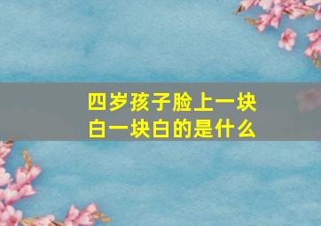 四岁孩子脸上一块白一块白的是什么