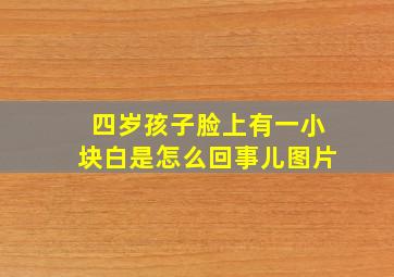 四岁孩子脸上有一小块白是怎么回事儿图片