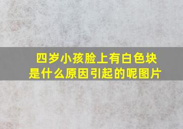 四岁小孩脸上有白色块是什么原因引起的呢图片