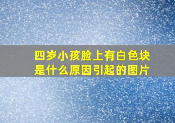 四岁小孩脸上有白色块是什么原因引起的图片