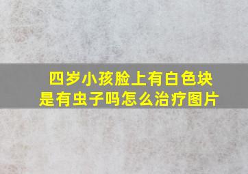 四岁小孩脸上有白色块是有虫子吗怎么治疗图片