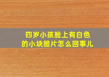 四岁小孩脸上有白色的小块图片怎么回事儿