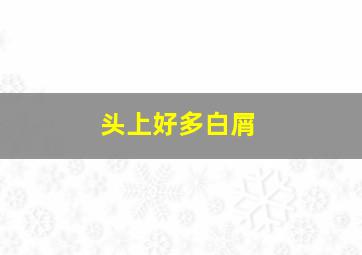 头上好多白屑