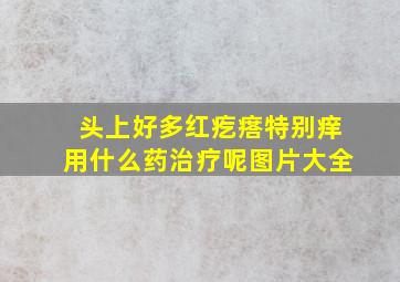 头上好多红疙瘩特别痒用什么药治疗呢图片大全