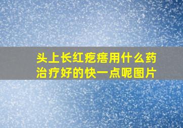 头上长红疙瘩用什么药治疗好的快一点呢图片