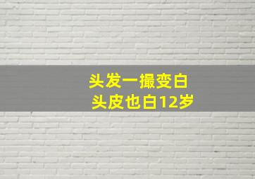 头发一撮变白头皮也白12岁