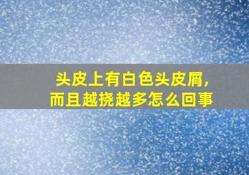 头皮上有白色头皮屑,而且越挠越多怎么回事