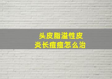 头皮脂溢性皮炎长痘痘怎么治