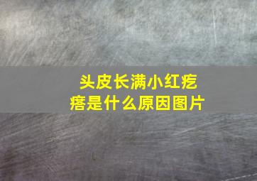 头皮长满小红疙瘩是什么原因图片