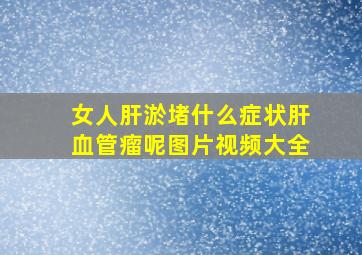 女人肝淤堵什么症状肝血管瘤呢图片视频大全