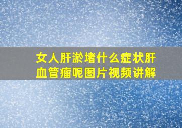 女人肝淤堵什么症状肝血管瘤呢图片视频讲解