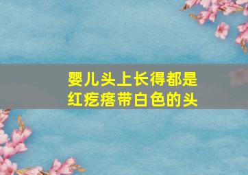 婴儿头上长得都是红疙瘩带白色的头