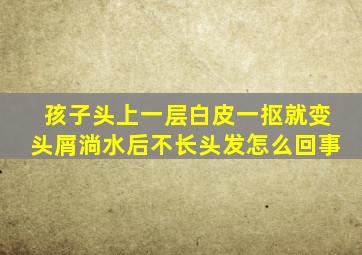 孩子头上一层白皮一抠就变头屑淌水后不长头发怎么回事