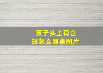 孩子头上有白斑怎么回事图片