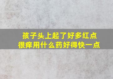 孩子头上起了好多红点很痒用什么药好得快一点