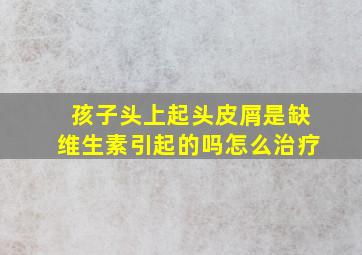 孩子头上起头皮屑是缺维生素引起的吗怎么治疗