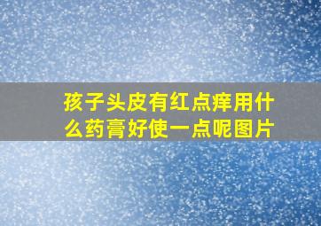 孩子头皮有红点痒用什么药膏好使一点呢图片