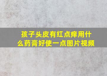 孩子头皮有红点痒用什么药膏好使一点图片视频