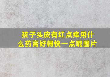 孩子头皮有红点痒用什么药膏好得快一点呢图片