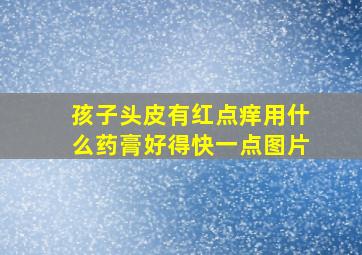 孩子头皮有红点痒用什么药膏好得快一点图片