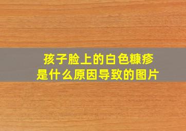 孩子脸上的白色糠疹是什么原因导致的图片