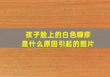 孩子脸上的白色糠疹是什么原因引起的图片