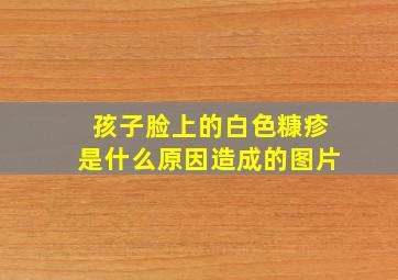 孩子脸上的白色糠疹是什么原因造成的图片