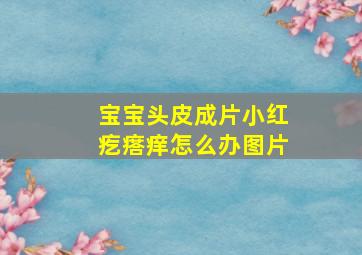 宝宝头皮成片小红疙瘩痒怎么办图片