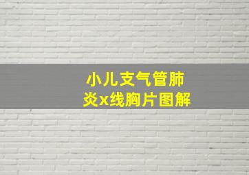 小儿支气管肺炎x线胸片图解