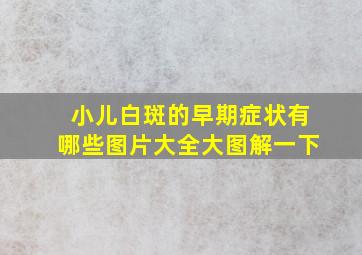 小儿白斑的早期症状有哪些图片大全大图解一下