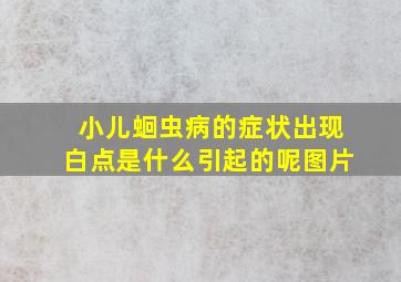 小儿蛔虫病的症状出现白点是什么引起的呢图片