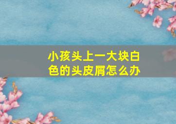 小孩头上一大块白色的头皮屑怎么办