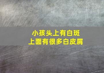 小孩头上有白斑上面有很多白皮屑