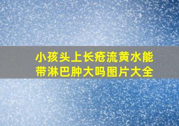 小孩头上长疮流黄水能带淋巴肿大吗图片大全