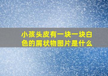 小孩头皮有一块一块白色的屑状物图片是什么